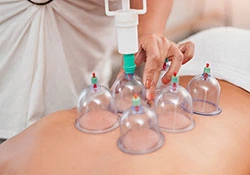 Cupping Clinic Services